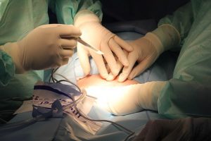 surgery procedure